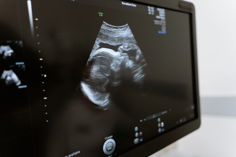 Winchester District Hospital purchases new ultrasound machine